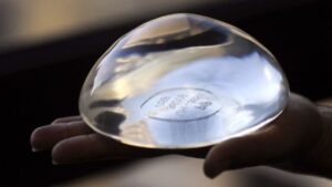 Túi trơn có an toàn không? So sánh độ bền và nguy cơ bao xơ với túi nhám