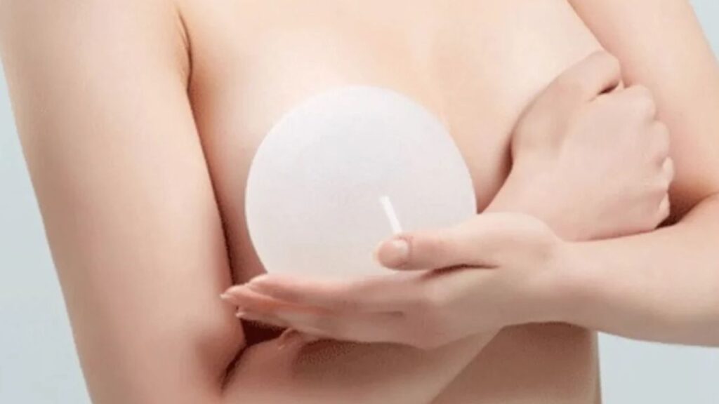 Túi ngực tròn có bị giả không? 4 yếu tố quyết định độ tự nhiên từ bác sĩ