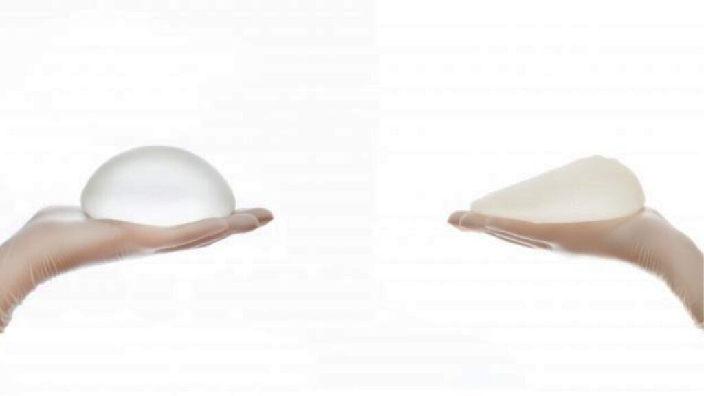 So sánh túi ngực tròn và giọt nước: Lựa chọn nào hoàn hảo cho vóc dáng phụ nữ Việt