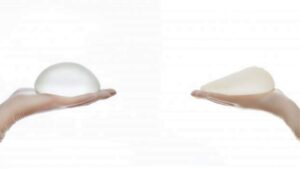 So sánh túi ngực tròn và giọt nước: Lựa chọn nào hoàn hảo cho vóc dáng phụ nữ Việt