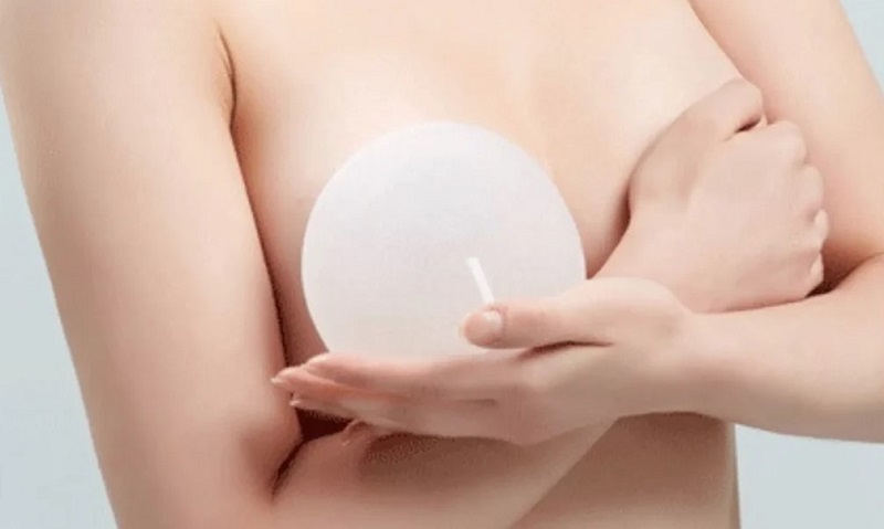 Lựa chọn túi độn kích thước vừa vặn với vóc dáng