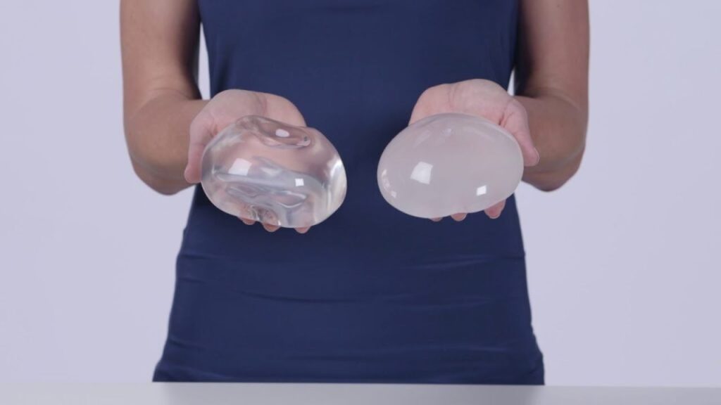 So sánh túi ngực nhám và trơn: Phân tích độ an toàn và tiêu chí lựa chọn