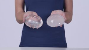 So sánh túi ngực nhám và trơn: Phân tích độ an toàn và tiêu chí lựa chọn