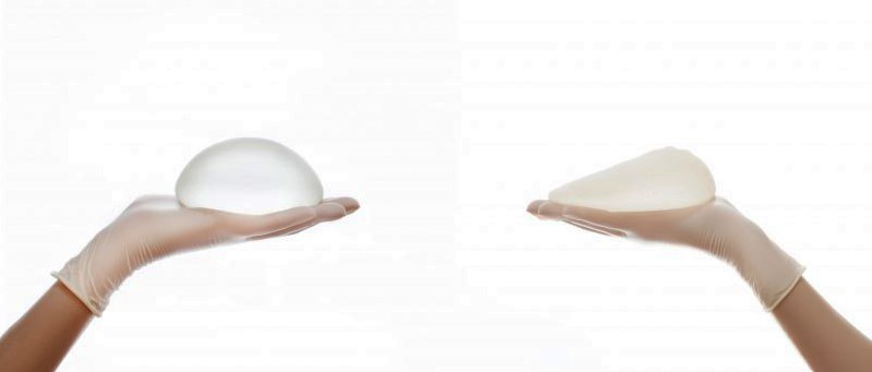 Lựa chọn túi độn tùy thuộc vào tình trạng và mong muốn của khách hàng