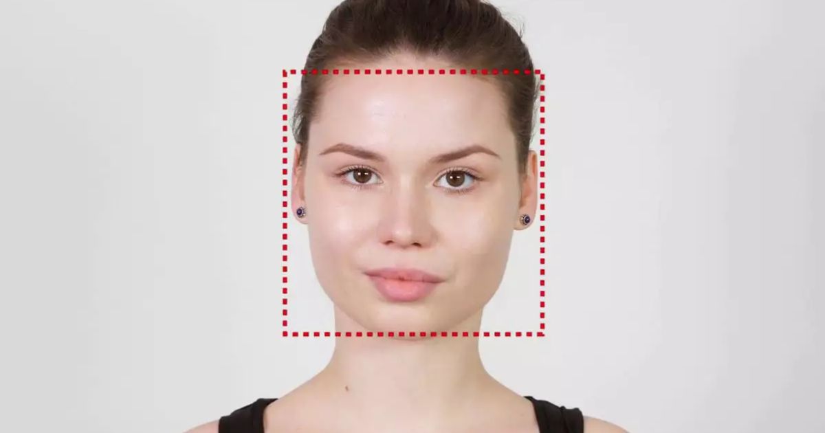 Cấu trúc xương mặt vuông do xương hàm bè ngang và gò má cao