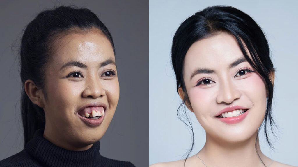 Báo chí nói gì về rào cản ngoại hình và cách Kangnam tiếp cận vấn đề này?