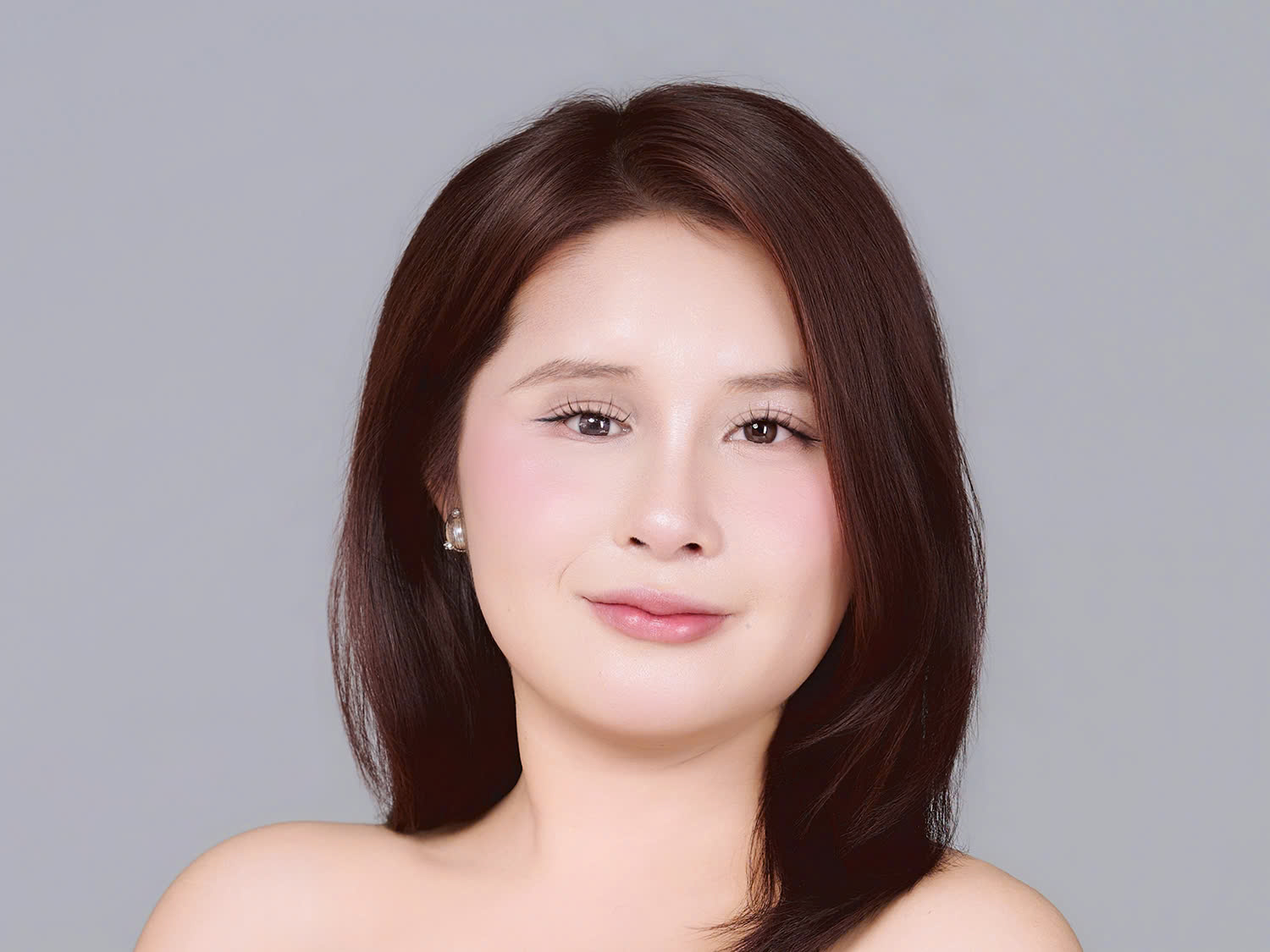 Sau phẫu thuật Yến sở hữu khuôn mặt tròn hài hòa, sống mũi cao, vóc dáng cân đối