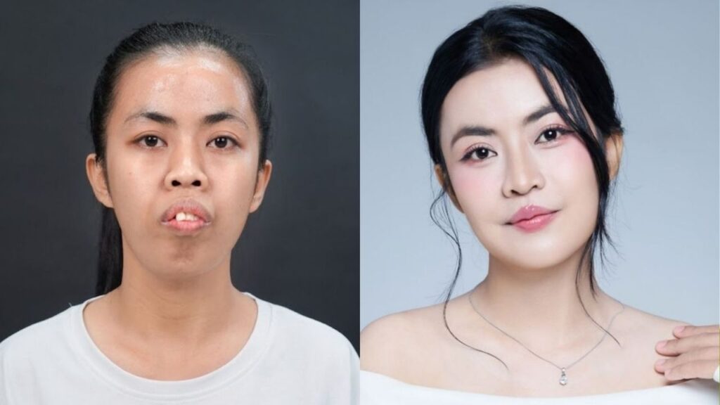 Báo Dân Việt đưa tin hành trình giúp người trẻ vượt qua mặc cảm ngoại hình của Kangnam?