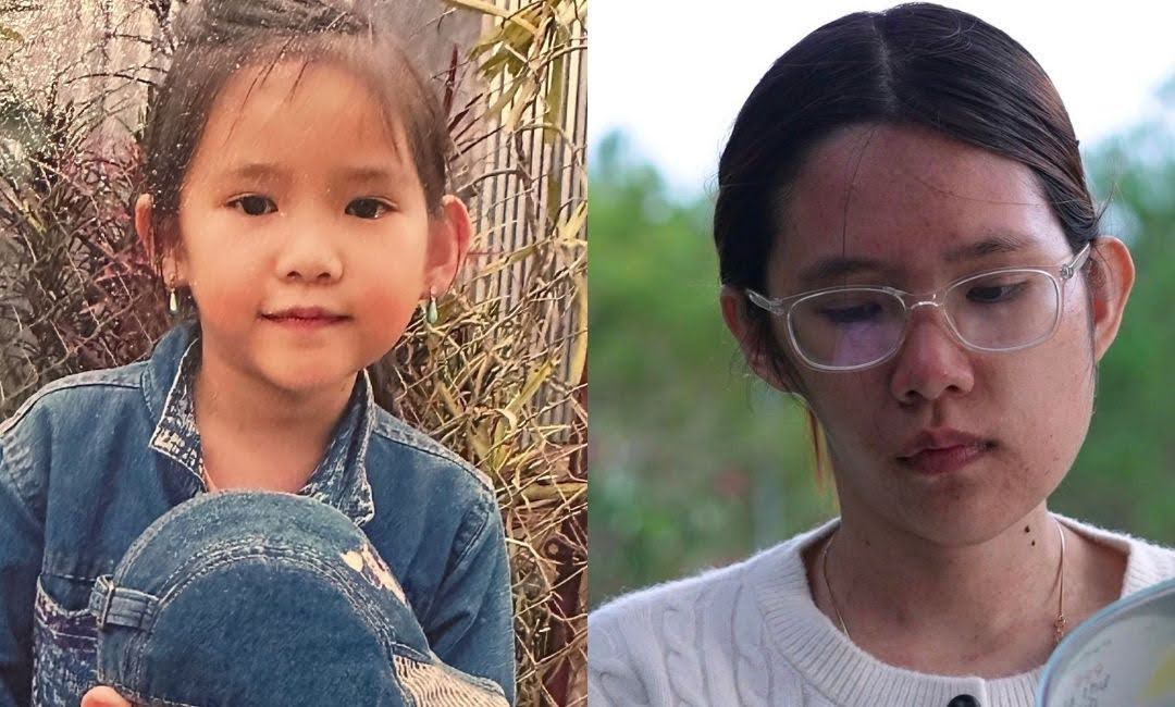 Bảo Ngọc Từng là một cô bé xinh đẹp nhưng lớn lên mặt em bắt đầu biến dạng