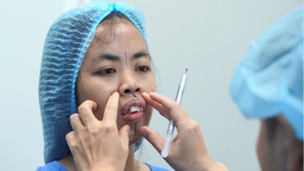 Chỉnh hàm và nâng mũi có làm cùng lúc không? Ai phù hợp để thực hiện 2 kỹ thuật này