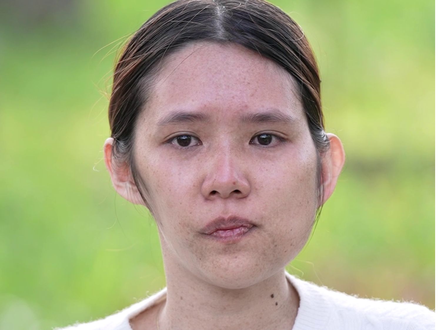 Trước đây Ngọc luôn tự ti vì gương mặt lệch, méo và thường xuyên bị bạn bè trêu chọc