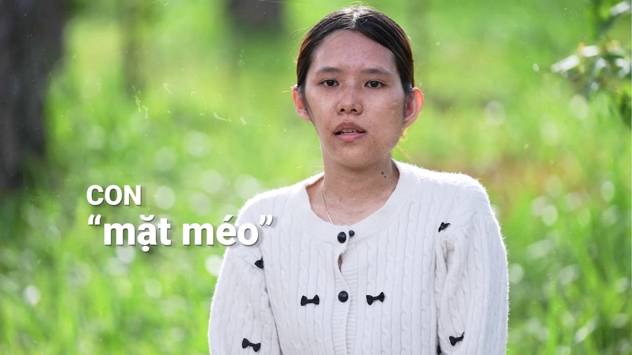 bảo ngọc xúc động chia sẻ về những ngày tháng bị bạn bè trêu chọc do ngoại hình khác biệt