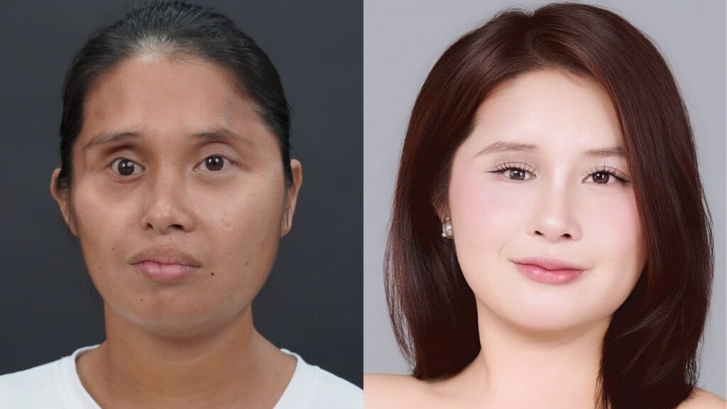Thay Đổi Như Lê Thị Yến Hành Trình Lột Xác Hết Bao Nhiêu Tiền? Hé Lộ Chi Phí Thực Tế