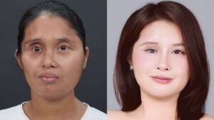 Thay Đổi Như Lê Thị Yến Hành Trình Lột Xác Hết Bao Nhiêu Tiền? Hé Lộ Chi Phí Thực Tế