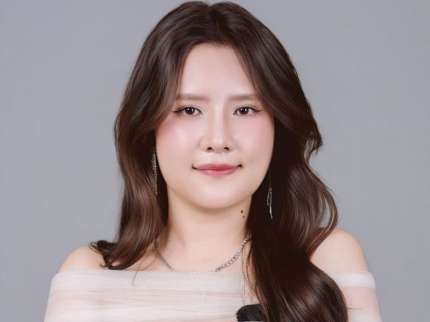 Sau phẫu thuật Bảo Ngọc sở hữu khuôn mặt cân đối, các đường nét hài hòa và thần thái đã tự tin hơn