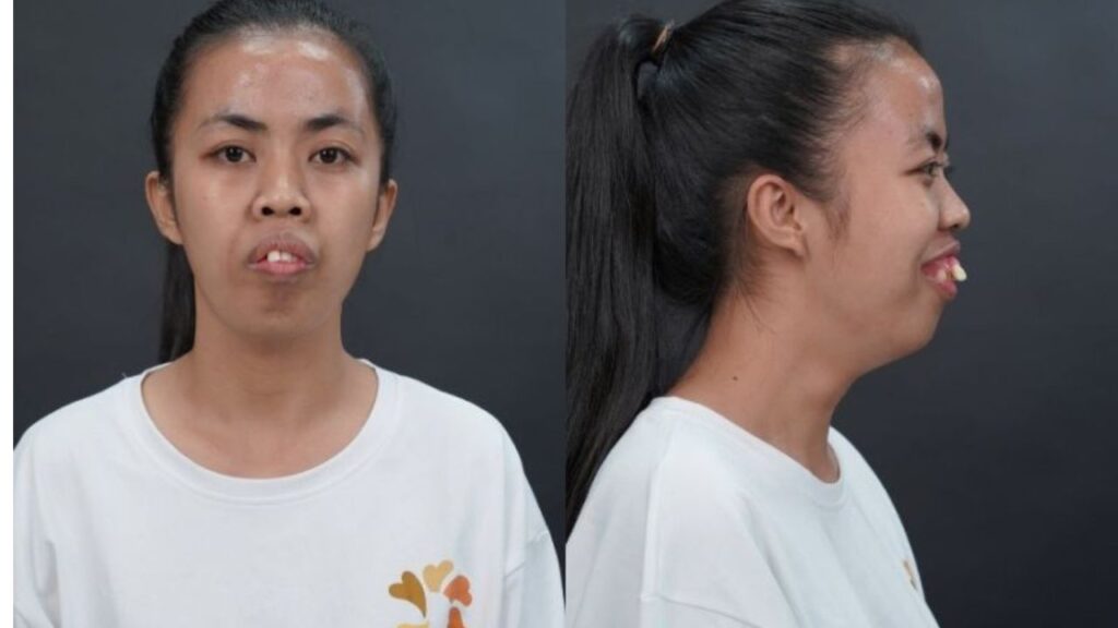 “Hành trình Lột xác”: Thay đổi ngoại hình, viết lại tương lai