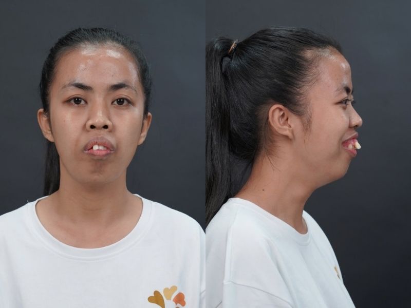 Thí sinh Trương Thị Trà My được lựa chọn phẫu thuật thẩm mỹ toàn diện