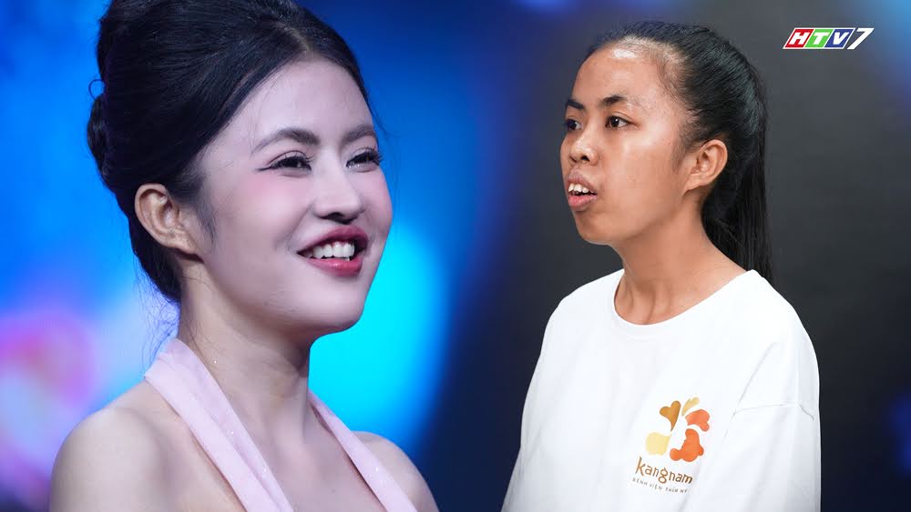 Trường hợp của Trương Thị Trà My được các bác sĩ tại Bệnh viện Thẩm mỹ Kangnam đánh giá là ca khó