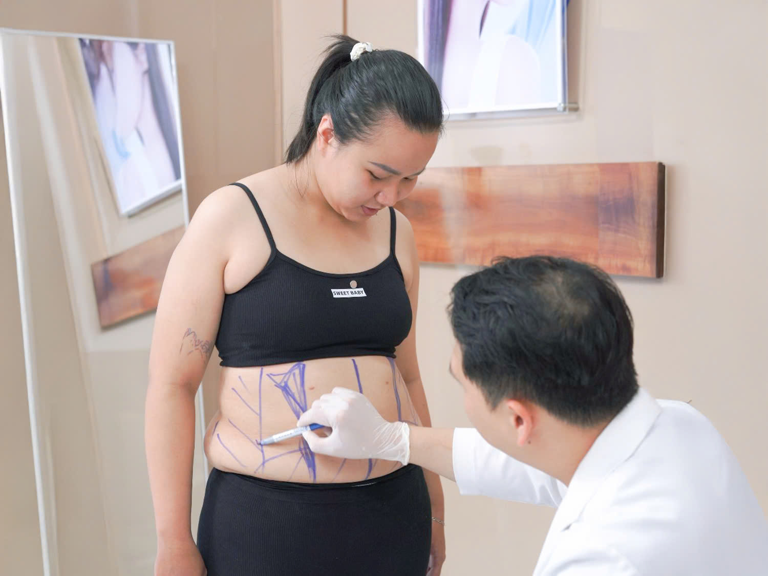 Bác sĩ thăm khám và đánh giá vị trí cần loại bỏ mỡ thừa cho Hân