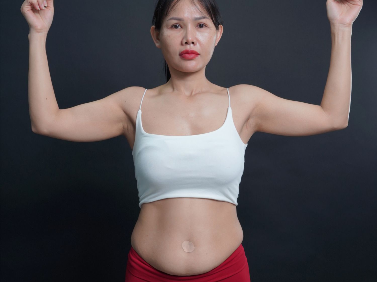 Chị Hoàng Diễm gặp tình trạng mỡ thừa tích tụ nhiều tại vùng bụng sau khi sinh 2 con