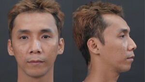 Lê Chí Nguyện – Chàng trai 5 năm chấp nhận vai quần chúng giấu tài năng sau hàm hô và sẹo rỗ