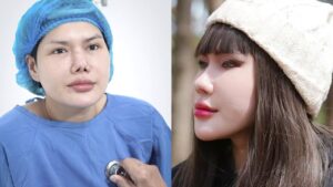 Giải cứu giấc mơ 5 lần sửa mũi, 5 lần thất bại. Hành trình sửa mũi hỏng của cô nàng Stylist