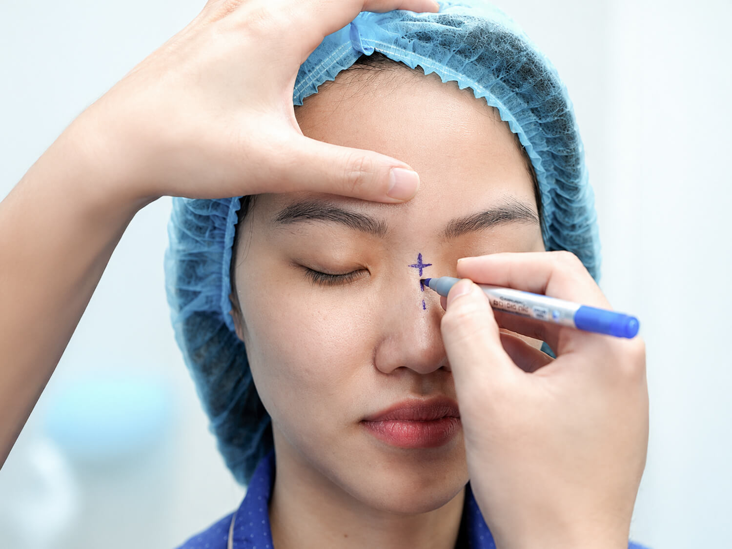 Bác sĩ Tân phác thảo dáng mũi, đánh dấu vị trí cần chỉnh sửa