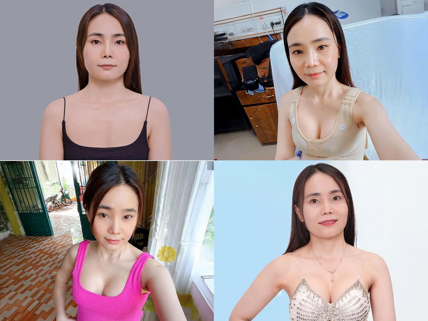 Hành trình thay đổi vòng 1 của chị Thúy sau 14 ngày