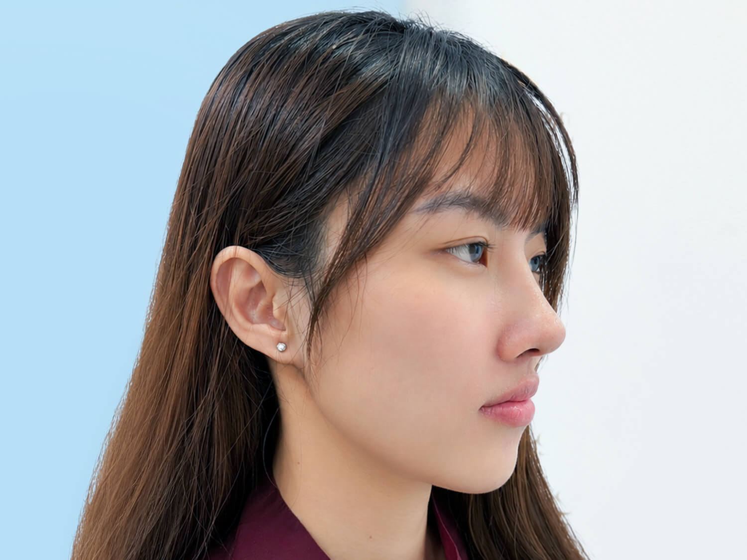 Sau 1 tháng dáng mũi của Ni đã vào form chuẩn đẹp, mũi cao thanh thoát và tự nhiên