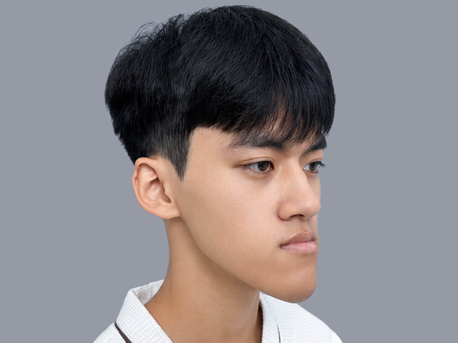 Đình Quyết gặp tình trạng khớp cắn ngược, xương hàm dưới phát triển quá mức