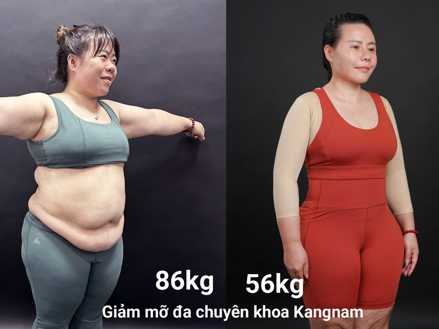 Chị Trần Thị Mai đến Hành trình lột xác với mong muốn thay đổi cả khuôn mặt và thoát mỡ