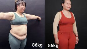 100 thoát mỡ an toàn: "mẹ siêu nhân" hạnh phúc khi loại bỏ 30 kg mỡ
