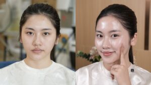 Khôi Phục Làn Da Khô Sạm của Thanh Hiền Bằng Nano Gold Extra