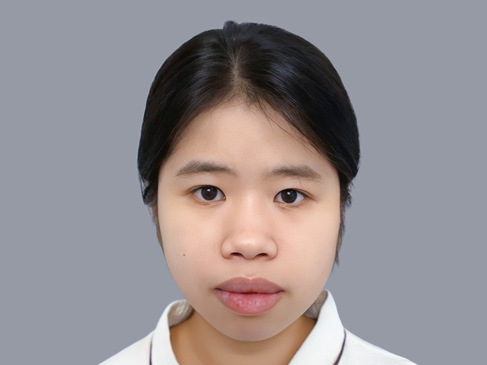 Cằm ngắn, lẹm mức độ trung bình đến nặng cân nhắc trượt cằm hoặc độn cằm