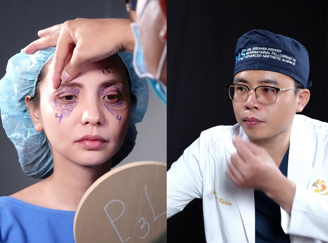 Bác sĩ Nguyễn Hữu Đoàn Kangnam đã có kinh nghiệm hơn 10 năm cắt mí và cấy mỡ trẻ hóa vùng mắt