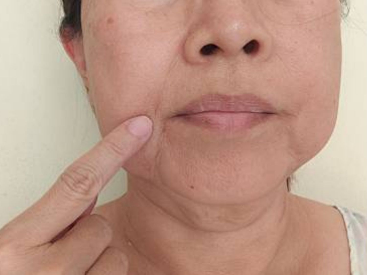 tình trạng da lão hóa nặng ở tuổi trung niên