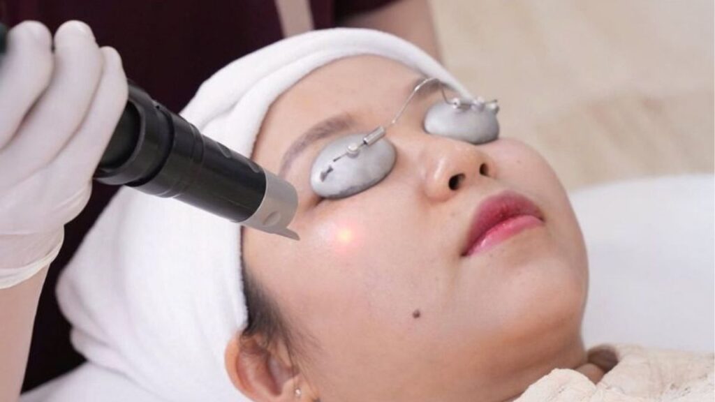 Điều Trị Da Liễu: Tổng Hợp Phương Pháp, Quy Trình Chuẩn Y Khoa Và Lưu Ý