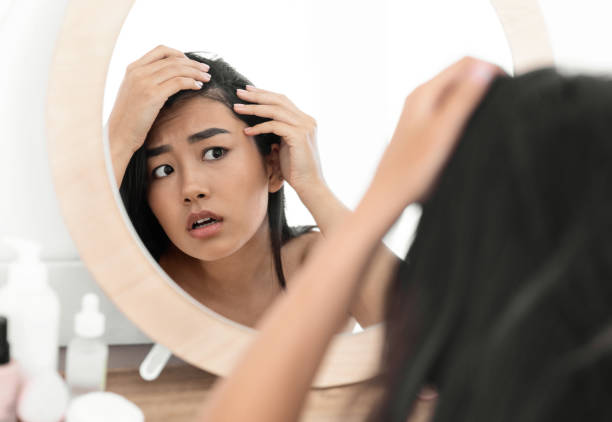 đi khám khi rụng tóc quá nhiều ảnh hưởng đến tâm lý
