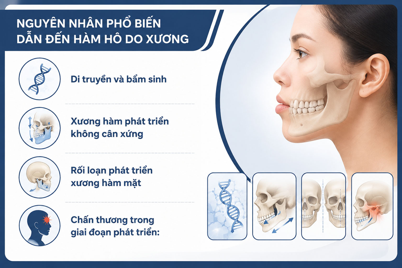 ảnh mô tả Nguyên nhân phổ biến dẫn đến hàm hô do xương