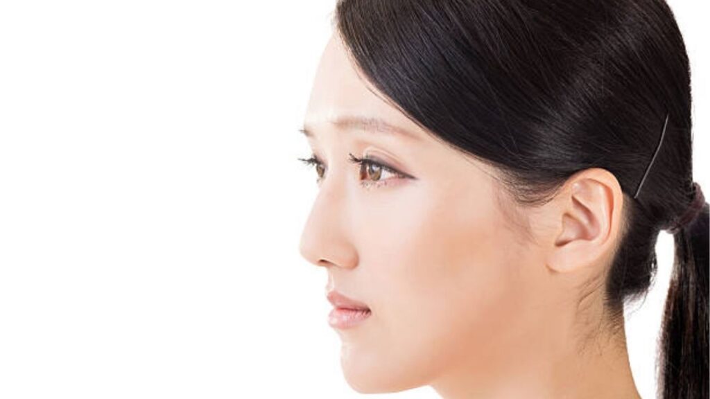 Nâng mũi bọc sụn tự thân là gì? Giải pháp cho da đầu mũi mỏng