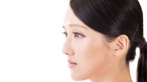 Nâng mũi bọc sụn tự thân là gì? Giải pháp cho da đầu mũi mỏng