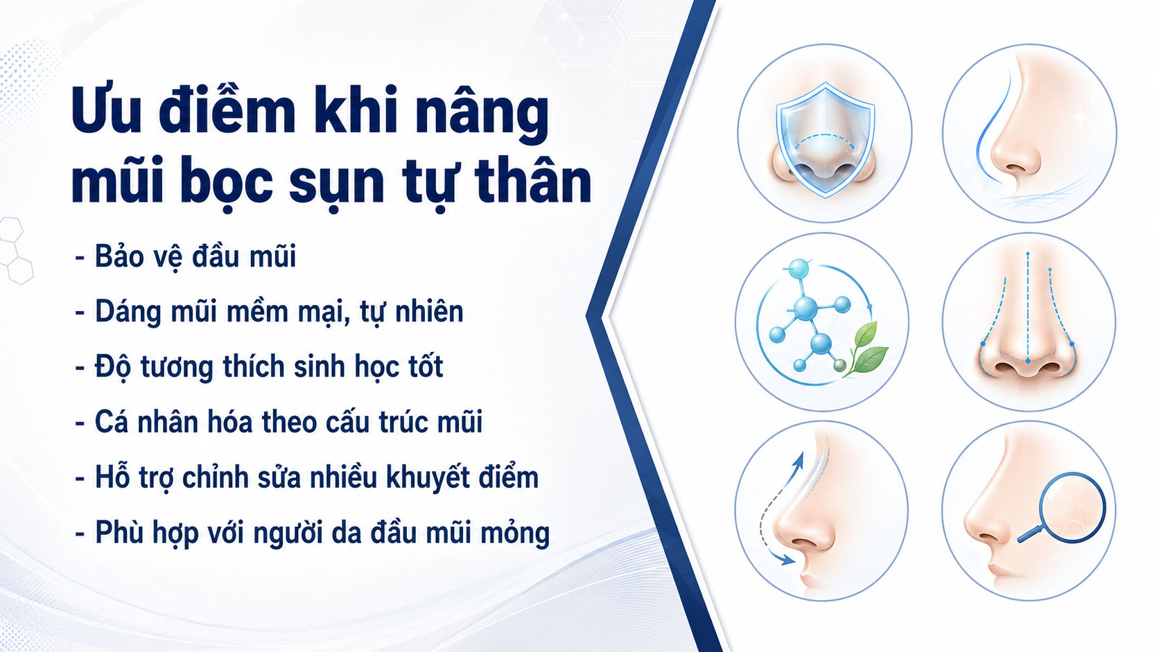 ảnh mô tả các Ưu điểm khi nâng mũi bọc sụn tự thân