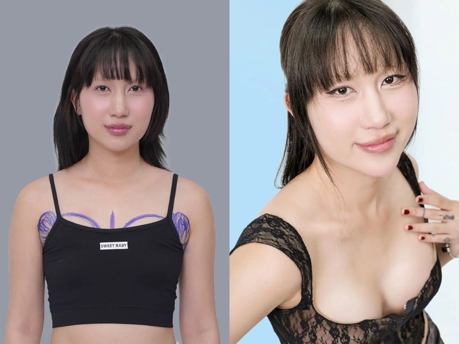 Ca sĩ Pay Xà Beng trước và sau khi nâng ngực tại Kangnam