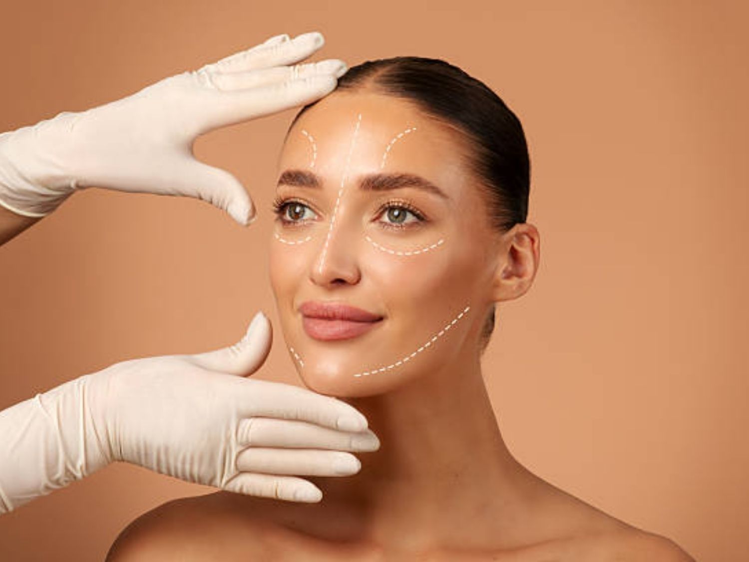 Phẫu thuật 3 điểm khuôn mặt là kỹ thuật đại phẫu can thiệp vào 3 vùng xương trọng yếu trên gương mặt, loại bỏ nét góc cạnh, thô cứng, biến gương mặt vuông