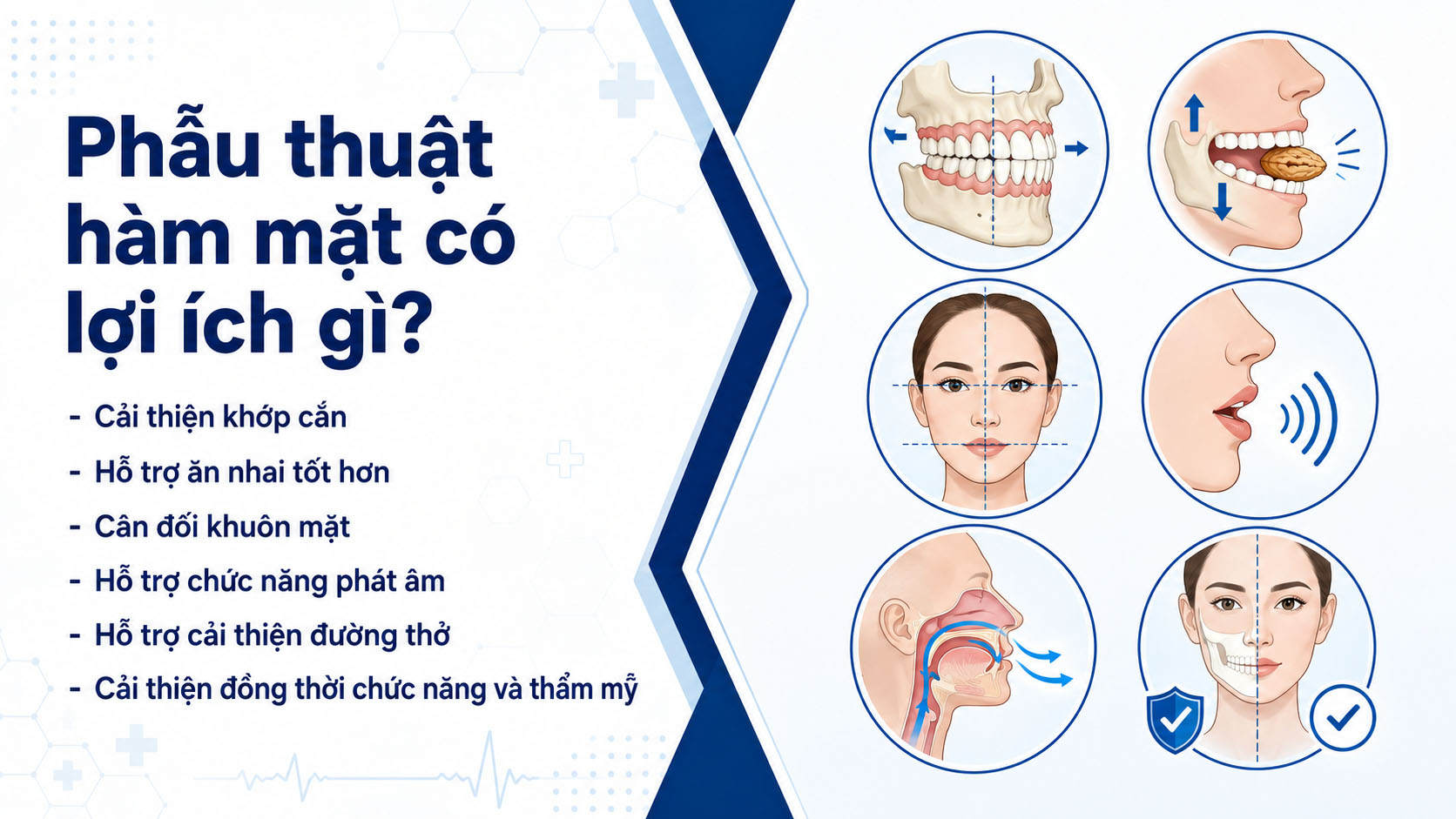 Phẫu thuật hàm mặt mang lại nhiều lợi ích, cân đối hàm, khớp cắn, tạo gương mặt cân đối