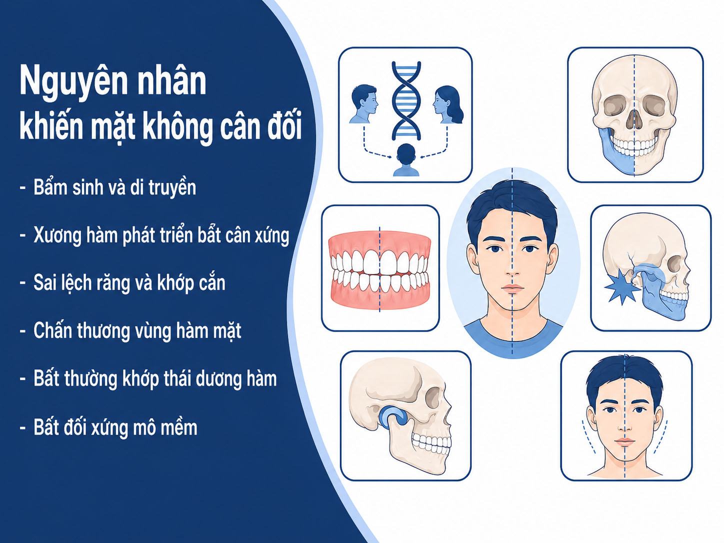 ảnh mô tả Nguyên nhân khiến mặt không cân đối