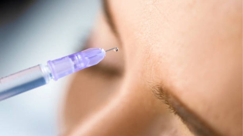 Tiêm Botox là gì? Công dụng, hiệu quả, tác dụng phụ và những điều cần biết