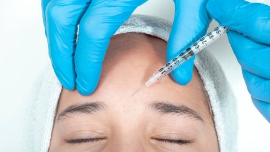 Tiêm Botox trẻ hóa là gì? Hiệu quả, vùng điều trị và những điều cần biết