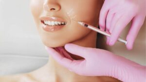 Tiêm Filler Là Gì? Tổng Hợp Kiến Thức Từ A-Z Chuẩn Y Khoa