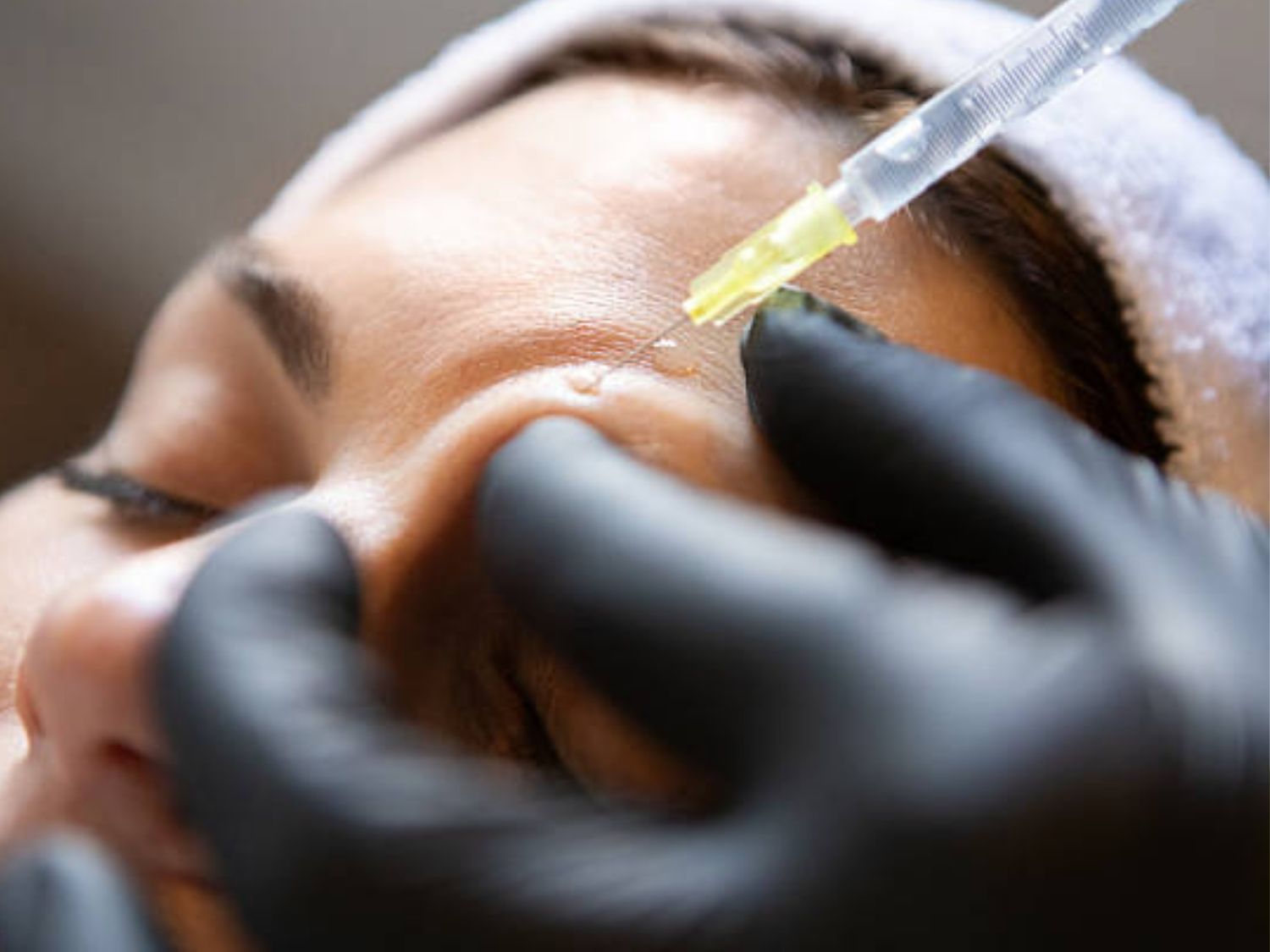 Tiêm filler đưa chất làm đầy vào vùng thiếu hụt trên gương mặt hoặc vùng cần cân chỉnh